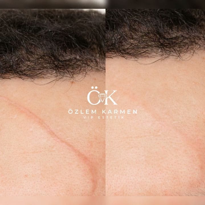 Post 10 by Özlem 💎 Karmen VIP Estetik on Instagram (video)