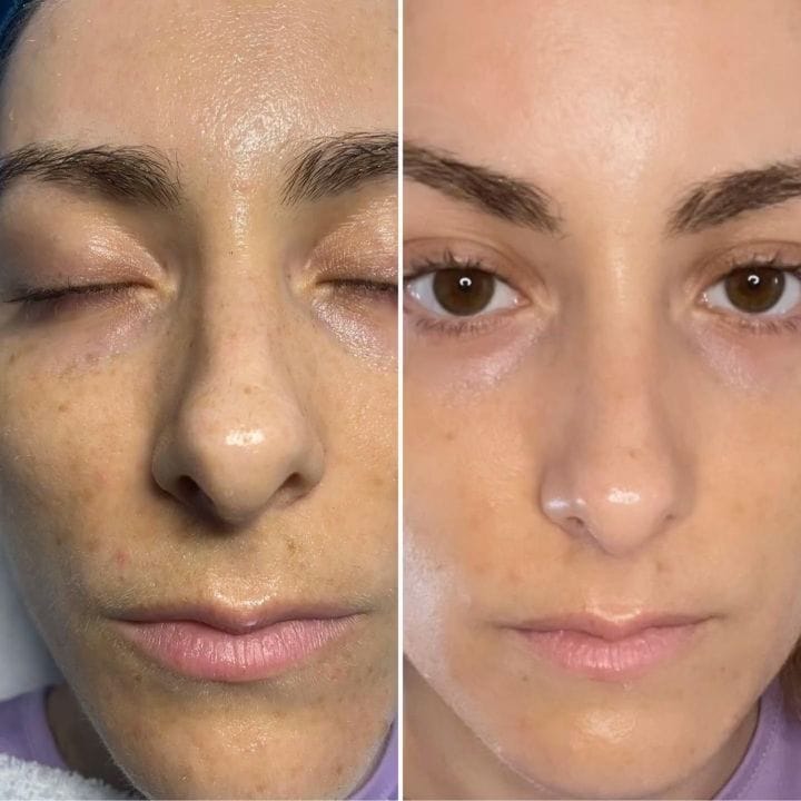 Post 2 by Özlem 💎 Karmen VIP Estetik on Instagram (video)