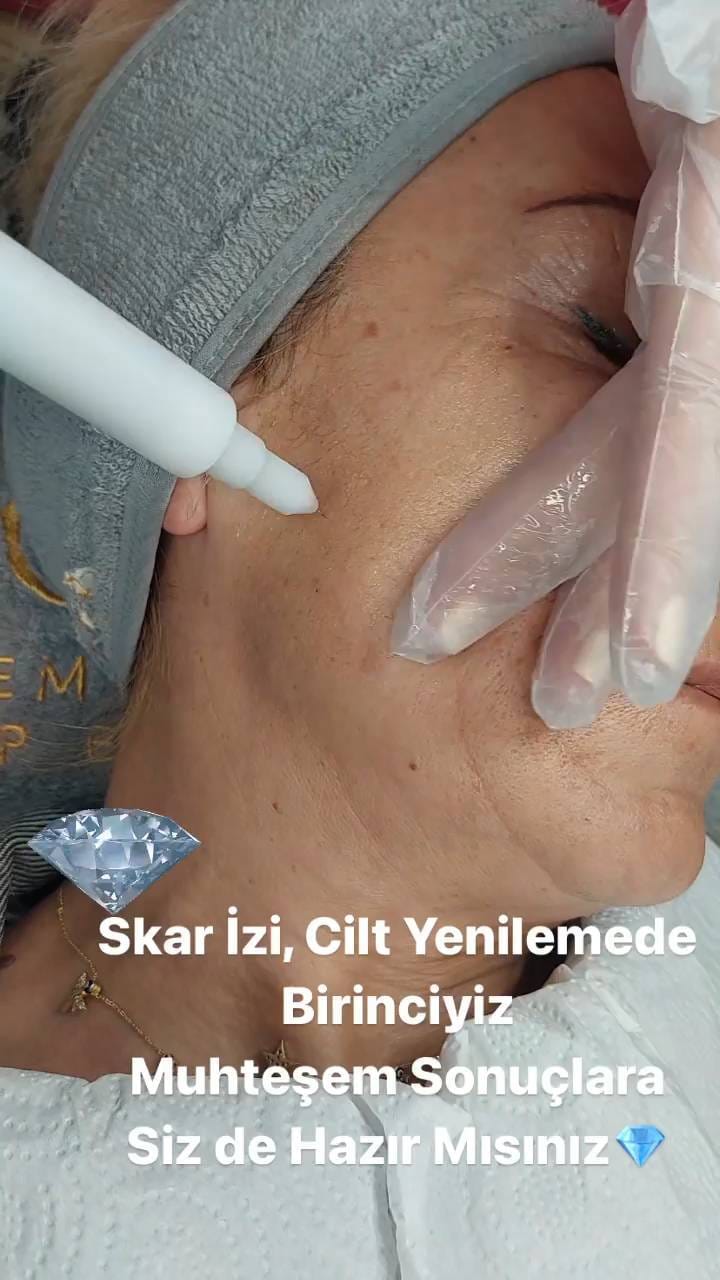 Post 8 by Özlem 💎 Karmen VIP Estetik on Instagram (video)