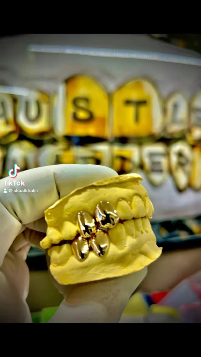 Post 2 by Gold Pointers on Instagram (video)