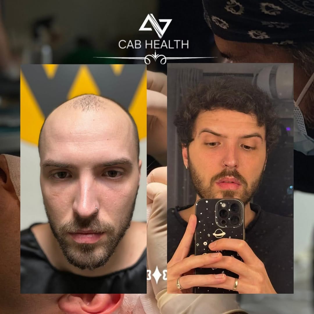 Post 6 by Ahmet Bayram on Instagram (image)