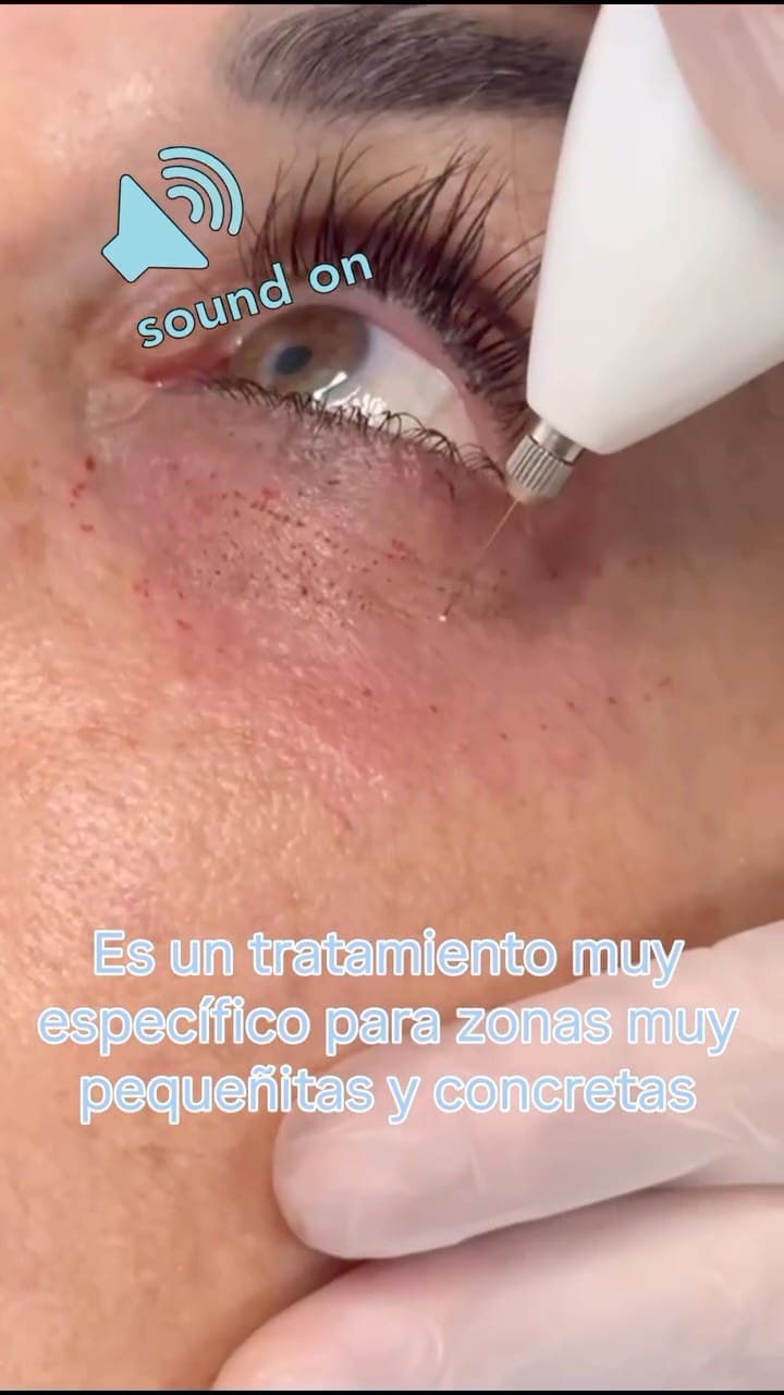 Post 6 by Línia Estètica Lleida✨ on Instagram (video)