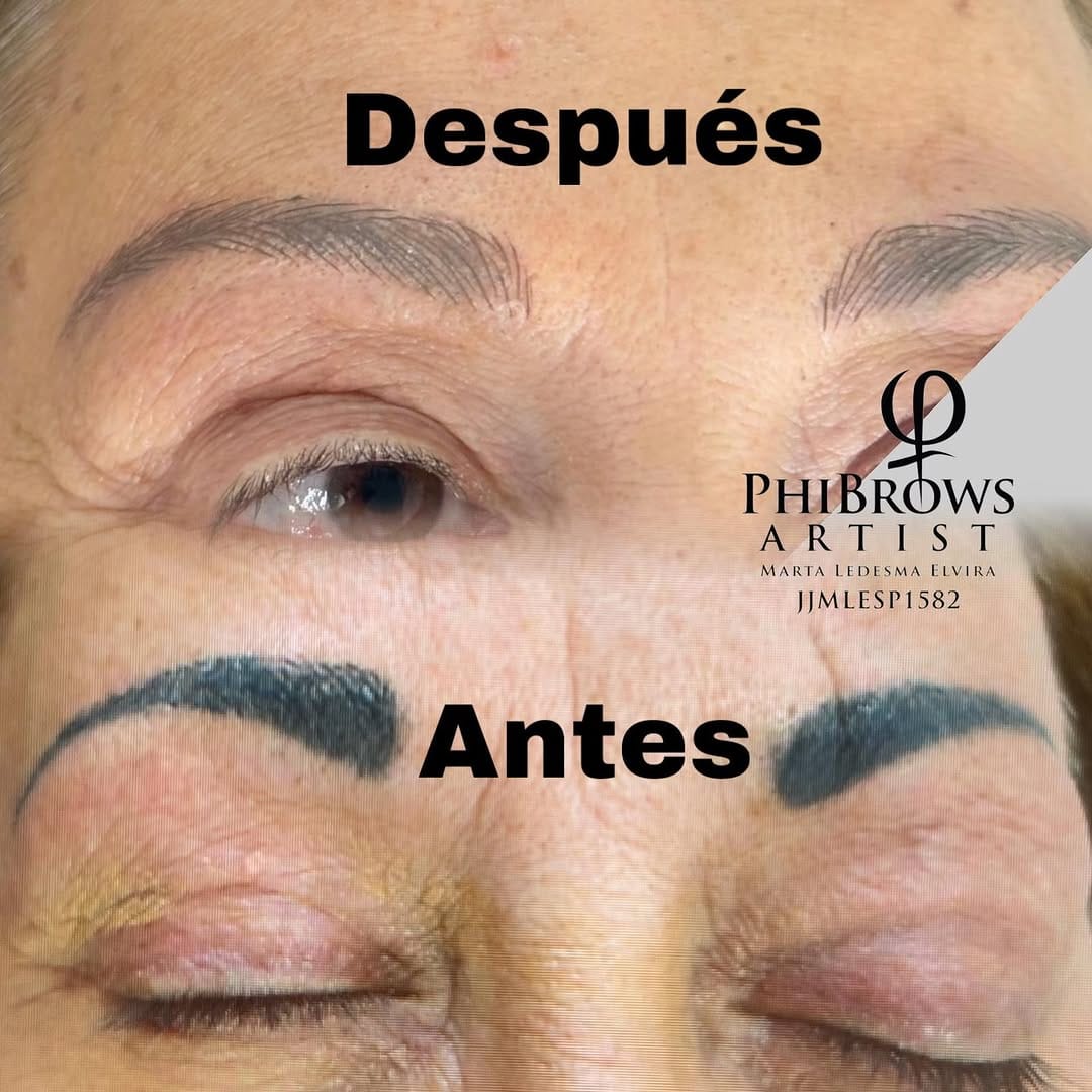 Post 2 by Línia Estètica Lleida✨ on Instagram (image)