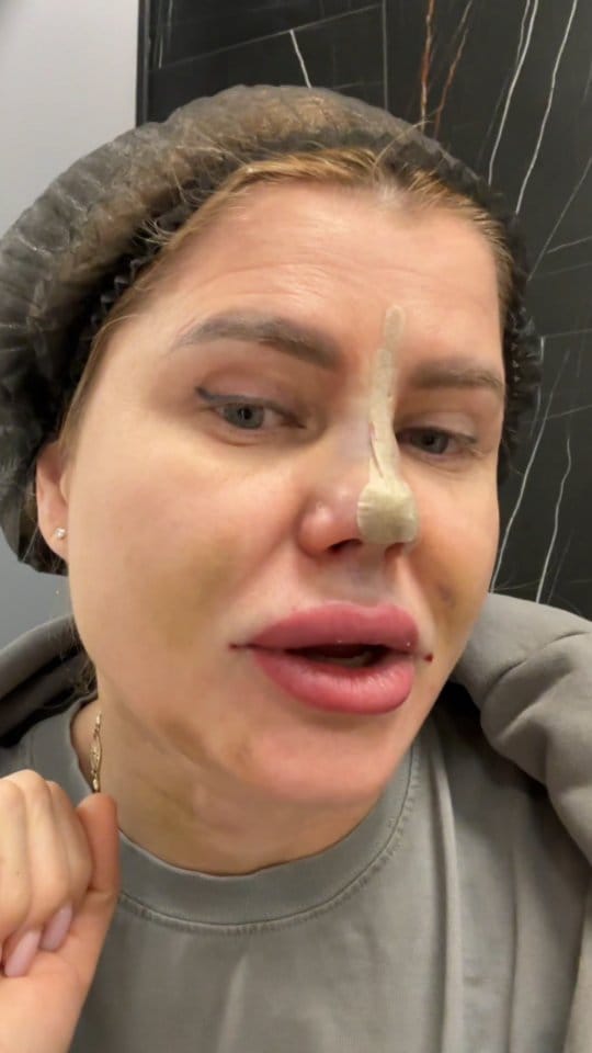 Post 5 by Dr. Alan Tigiev on Instagram (video)