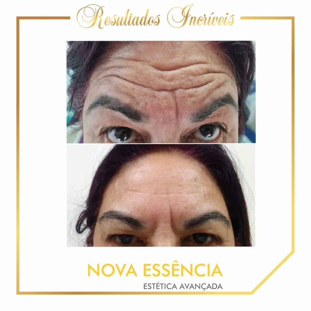 Post 7 by PÁGINA INATIVA on Instagram (image)
