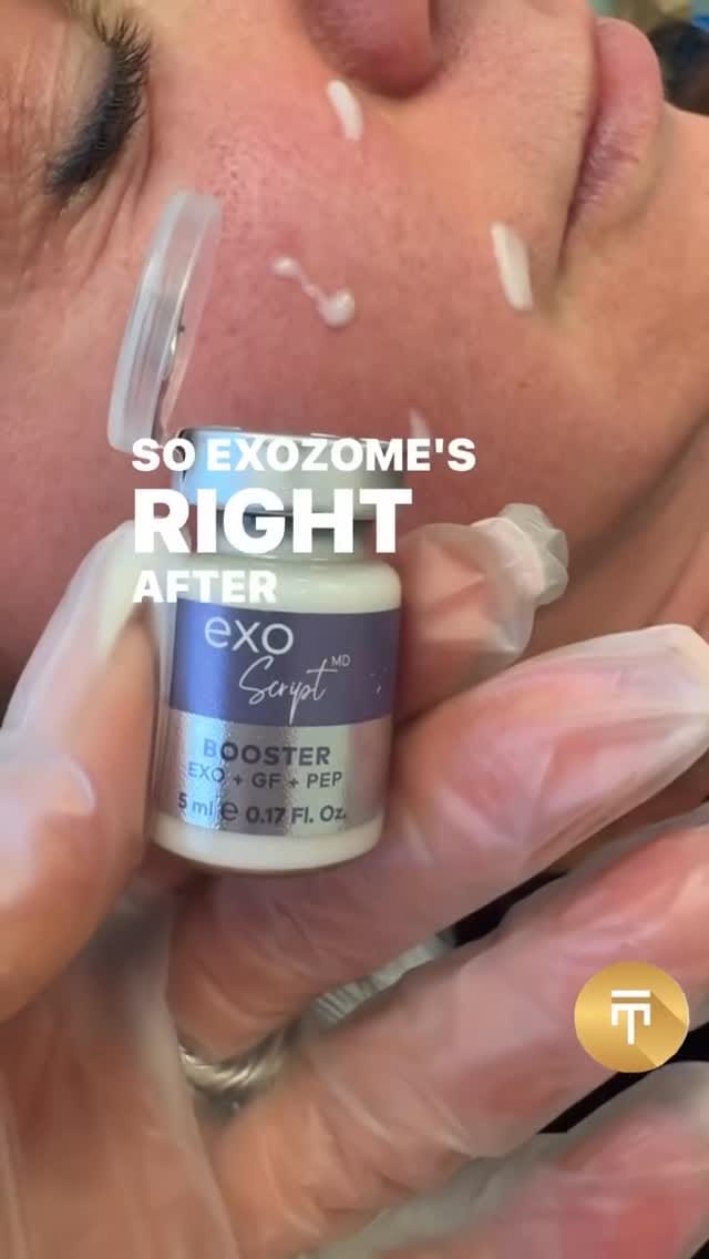Post 5 by ADOREYES BEAUTY on Instagram (video)