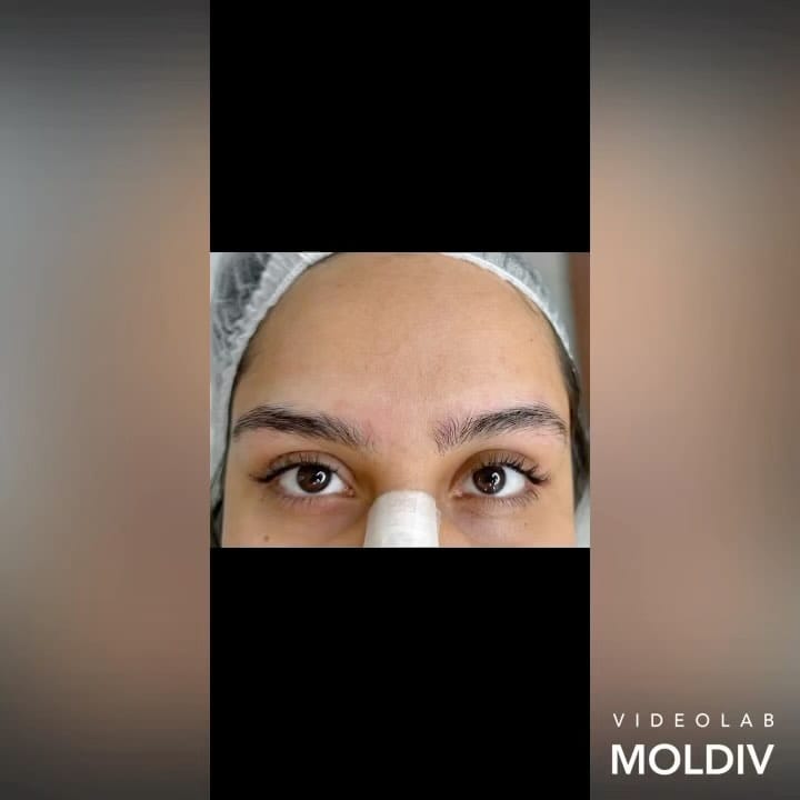 Post 7 by Yeganeh_mıcro_phıbrows on Instagram (video)