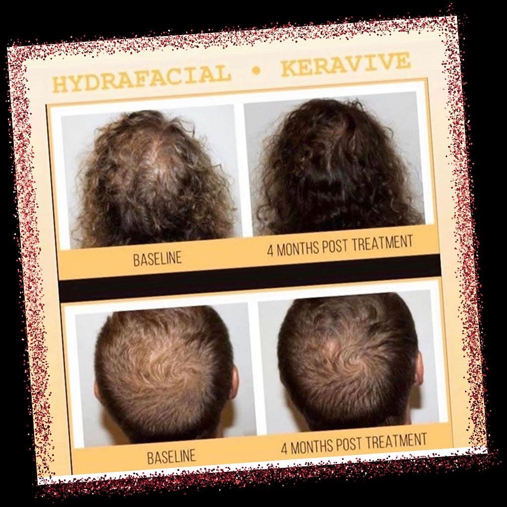 Post 9 by Luxe Aesthetic & Artistry Spa on Instagram (image)