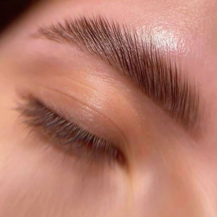 Post 2 by Turi Kitti Beauty - Aesthetic Master on Instagram (image)