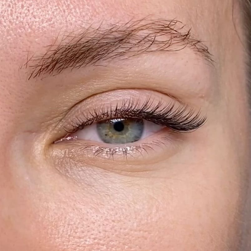 Post 4 by Turi Kitti Beauty - Aesthetic Master on Instagram (image)