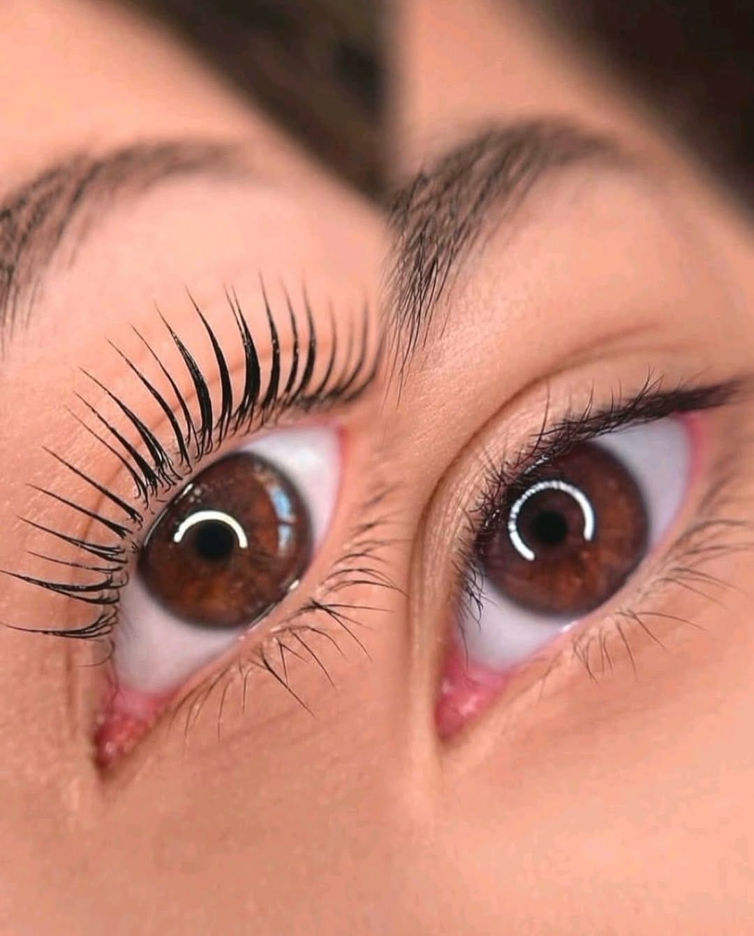 Post 5 by Turi Kitti Beauty - Aesthetic Master on Instagram (image)