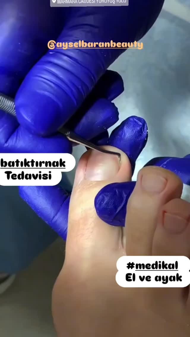 Post 2 by AYSELBARANBEAUTY on Instagram (video)