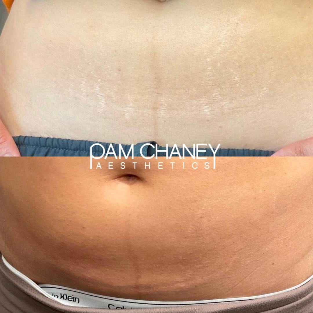 Post 1 by Pam Chaney Aesthetics and Wellness on Instagram (image)