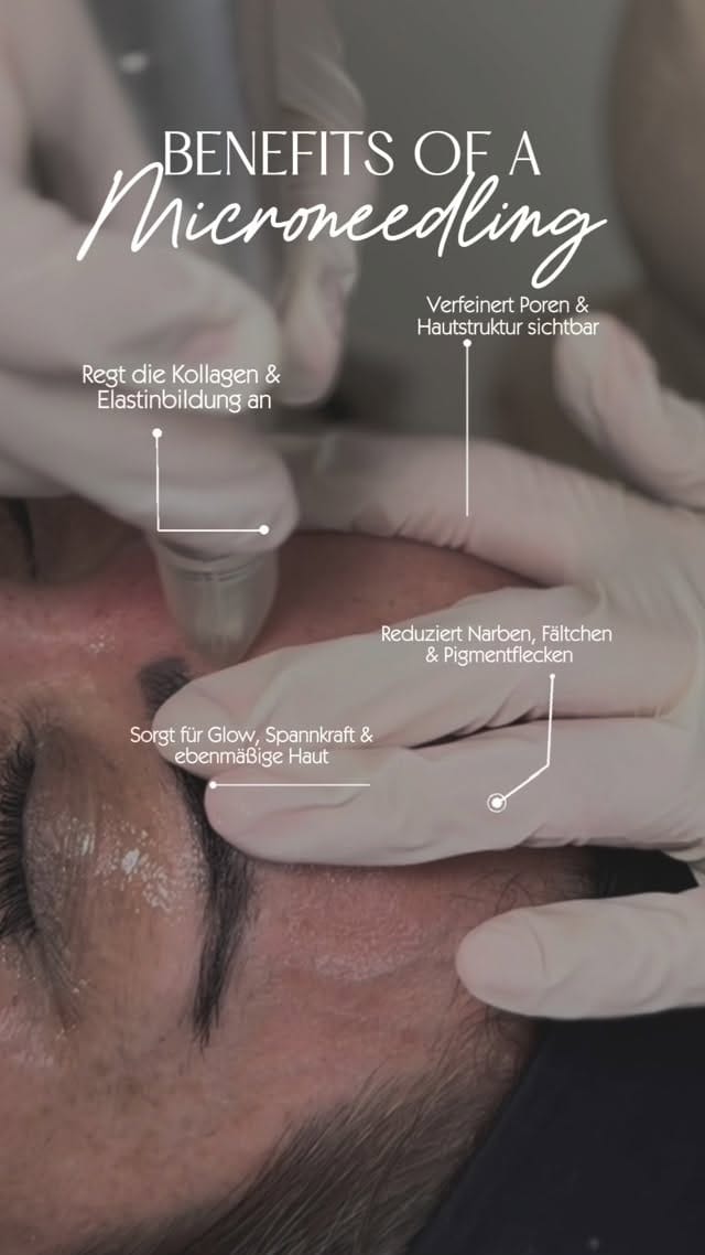 Post 7 by 𝐌𝐲 𝐄𝐬𝐭𝐡𝐞𝐭𝐢𝐜 Düsseldorf on Instagram (video)