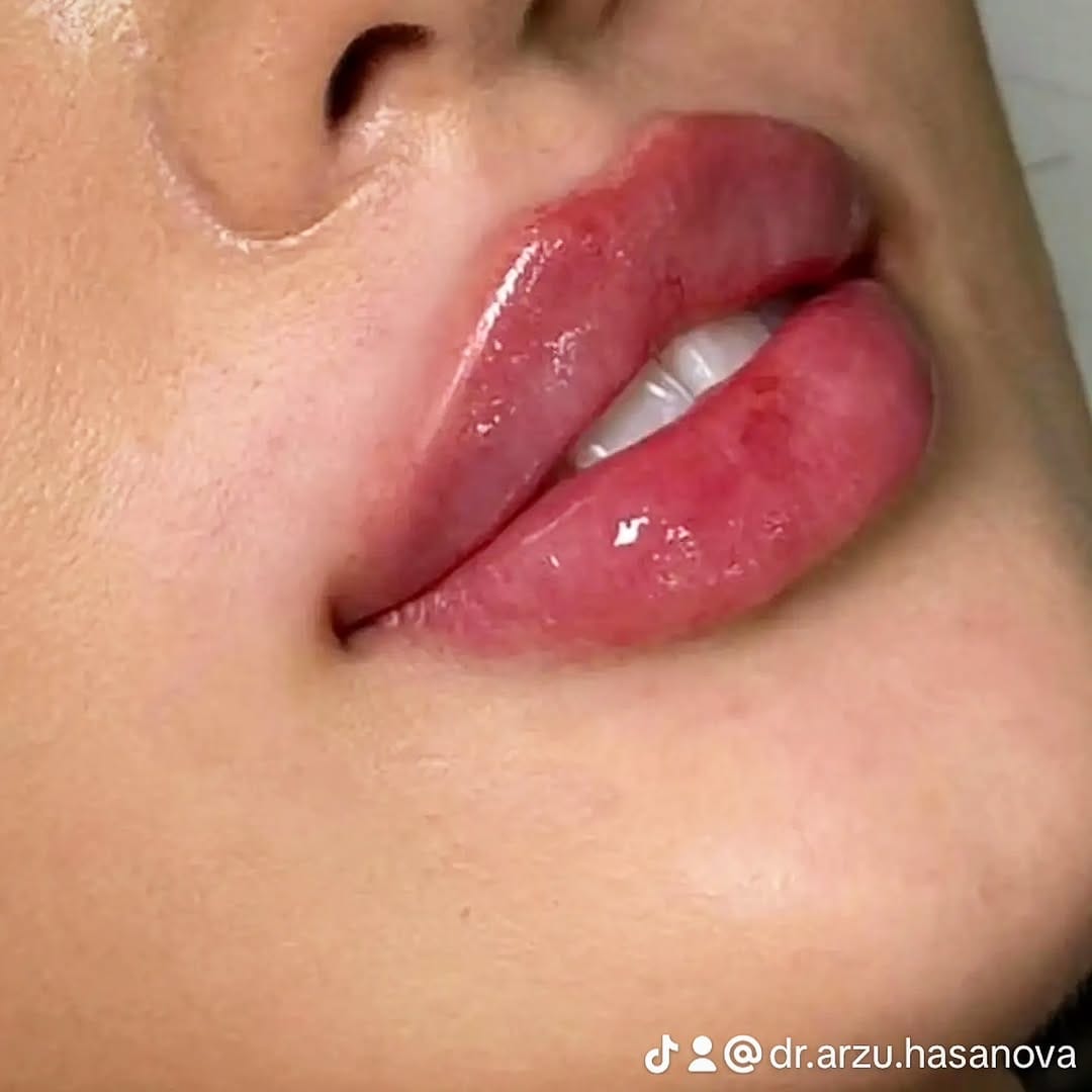 Post 3 by dr.Arzu Həsənova 🇦🇿 on Instagram (carousel)