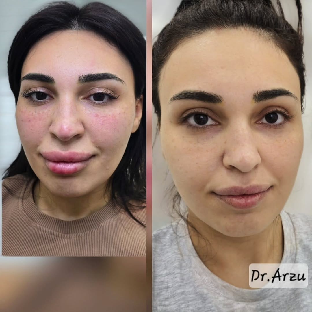 Post 6 by dr.Arzu Həsənova 🇦🇿 on Instagram (image)