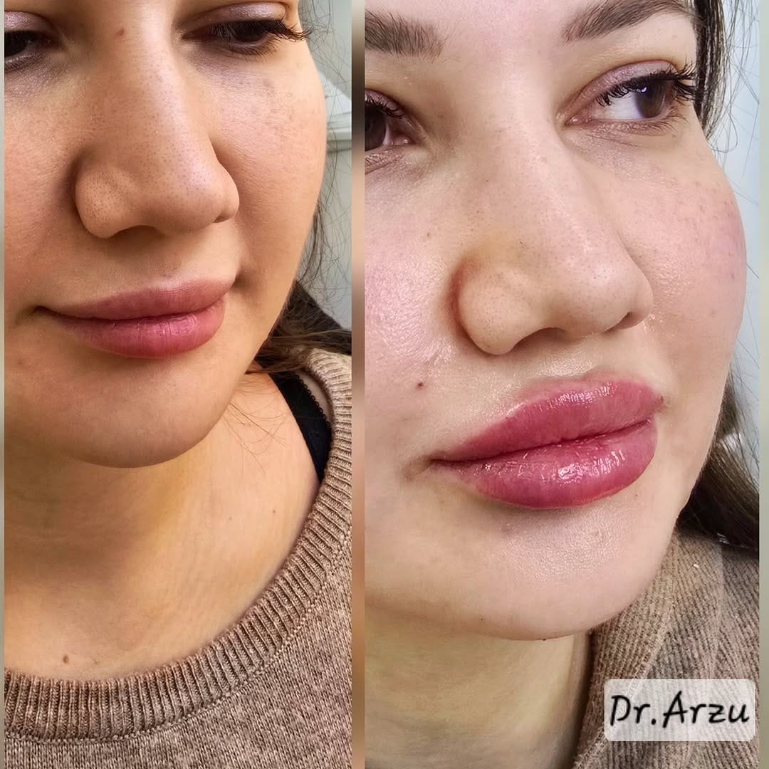 Post 5 by dr.Arzu Həsənova 🇦🇿 on Instagram (image)