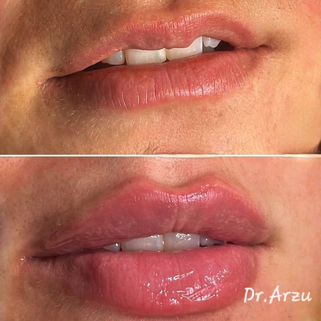 Post 4 by dr.Arzu Həsənova 🇦🇿 on Instagram (image)