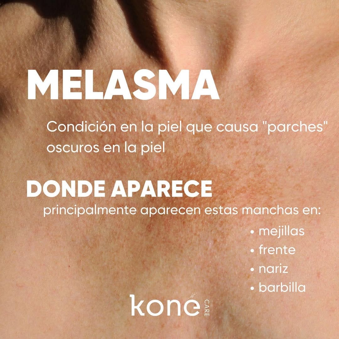 Post 8 by Koné Care | cosmética limpia on Instagram (carousel)