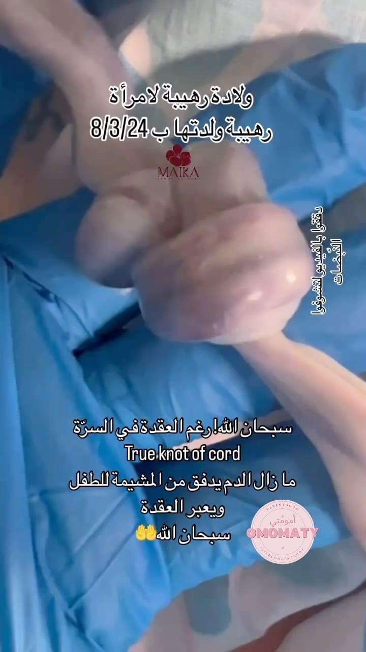 Post 8 by OMOMATY on Instagram (video)