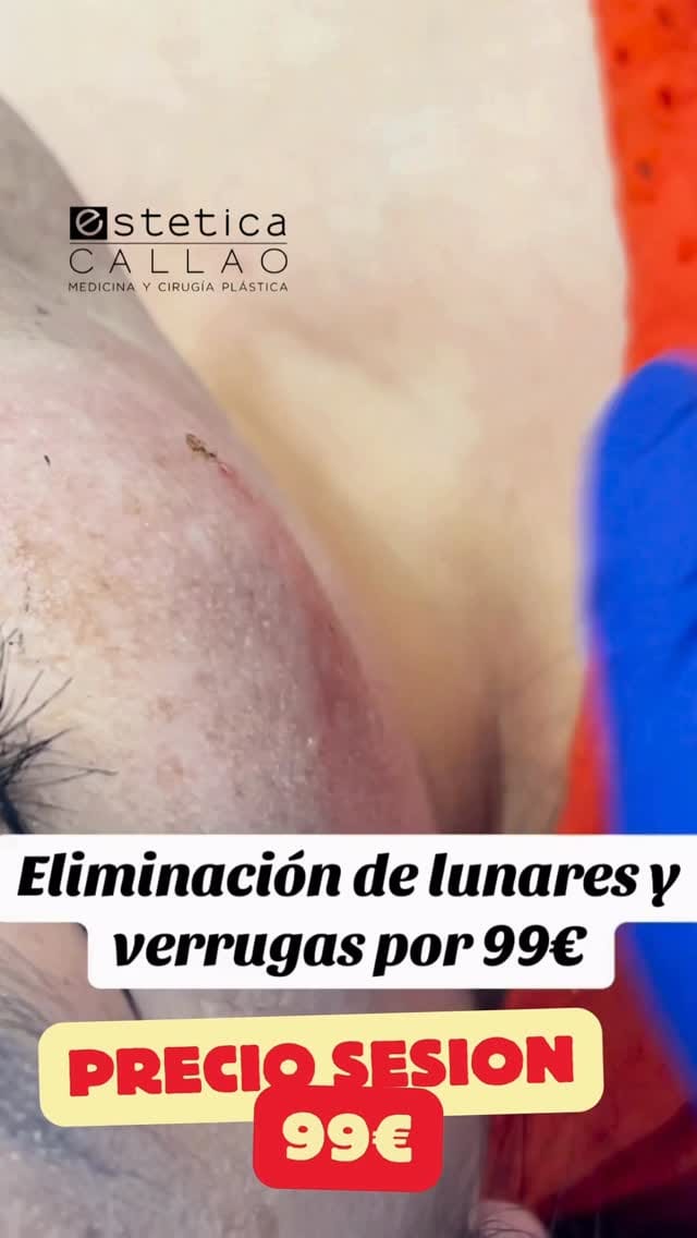 Post 8 by Medicina Estética Callao on Instagram (video)