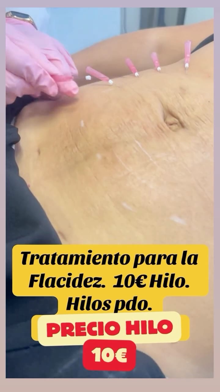 Post 3 by Medicina Estética Callao on Instagram (video)