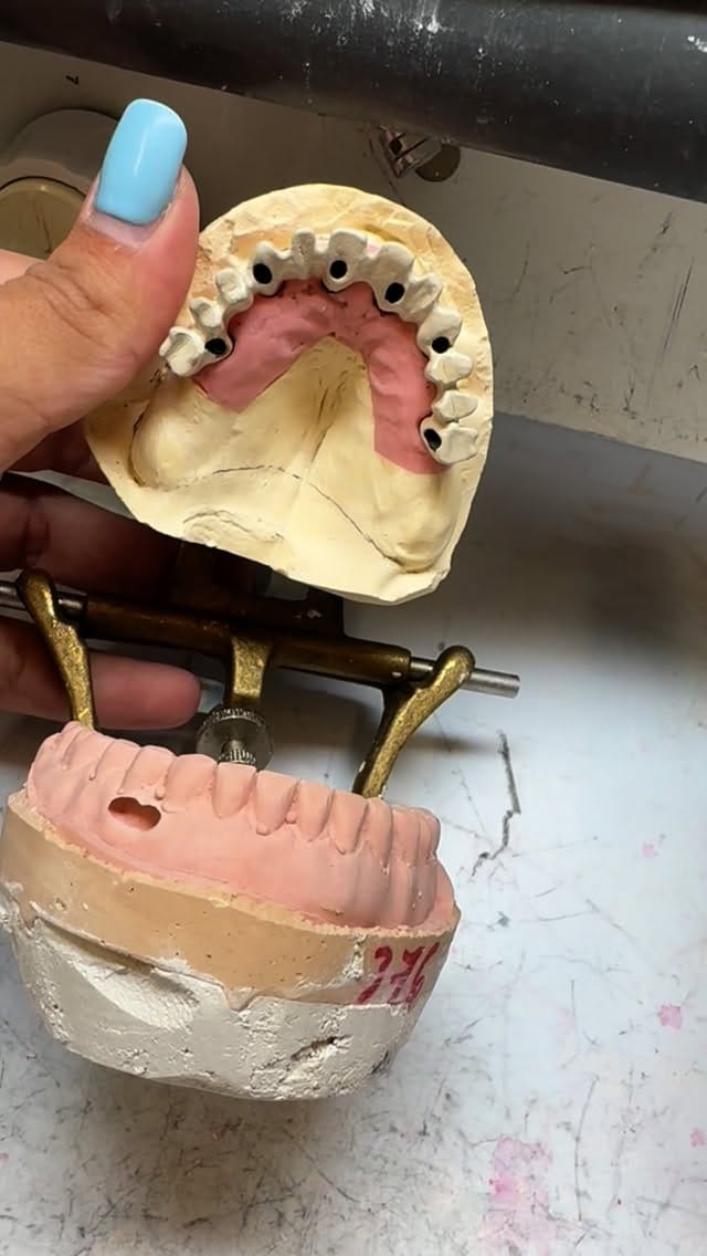 Post 6 by 🦷Séysha dental🦷 on Instagram (video)