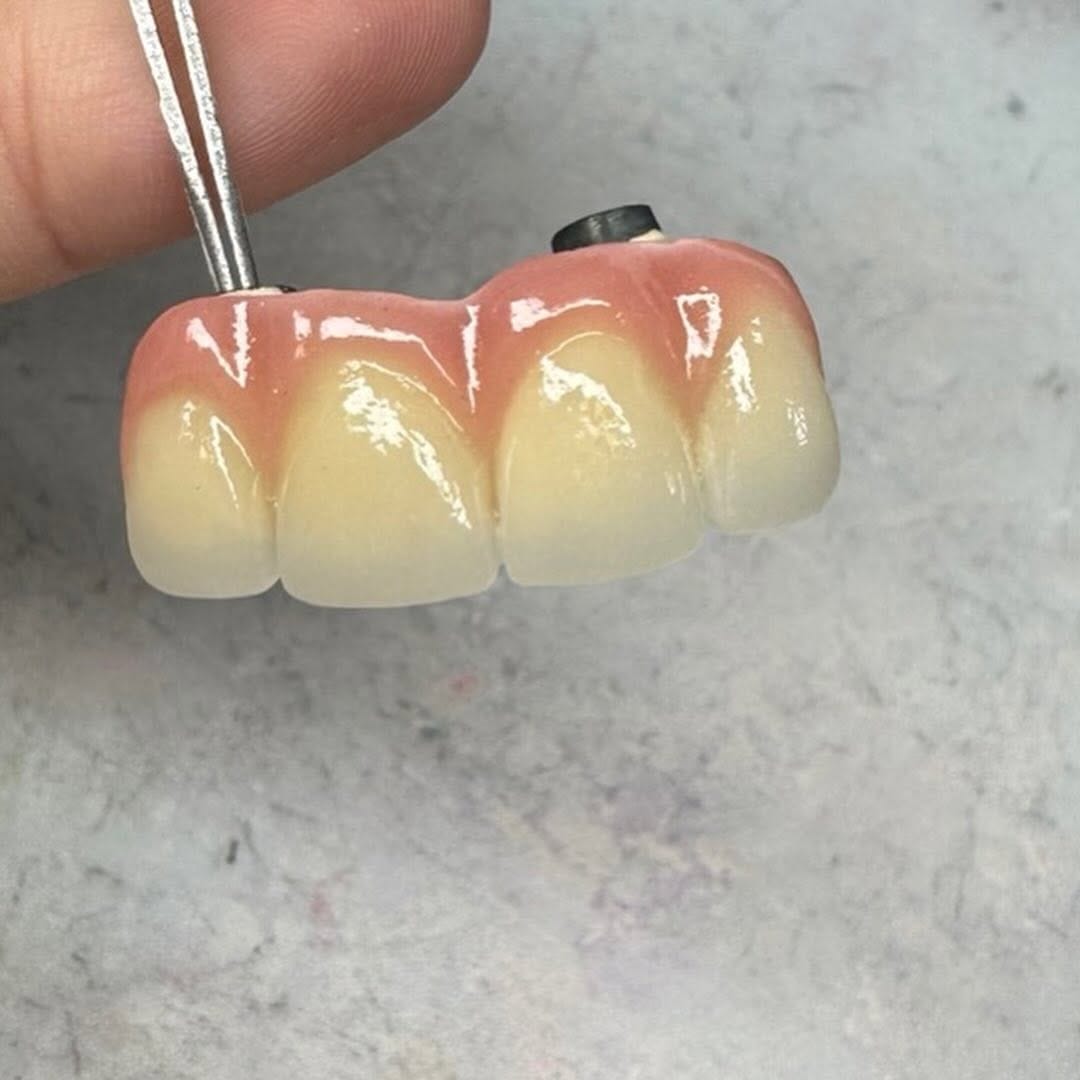 Post 3 by 🦷Séysha dental🦷 on Instagram (carousel)