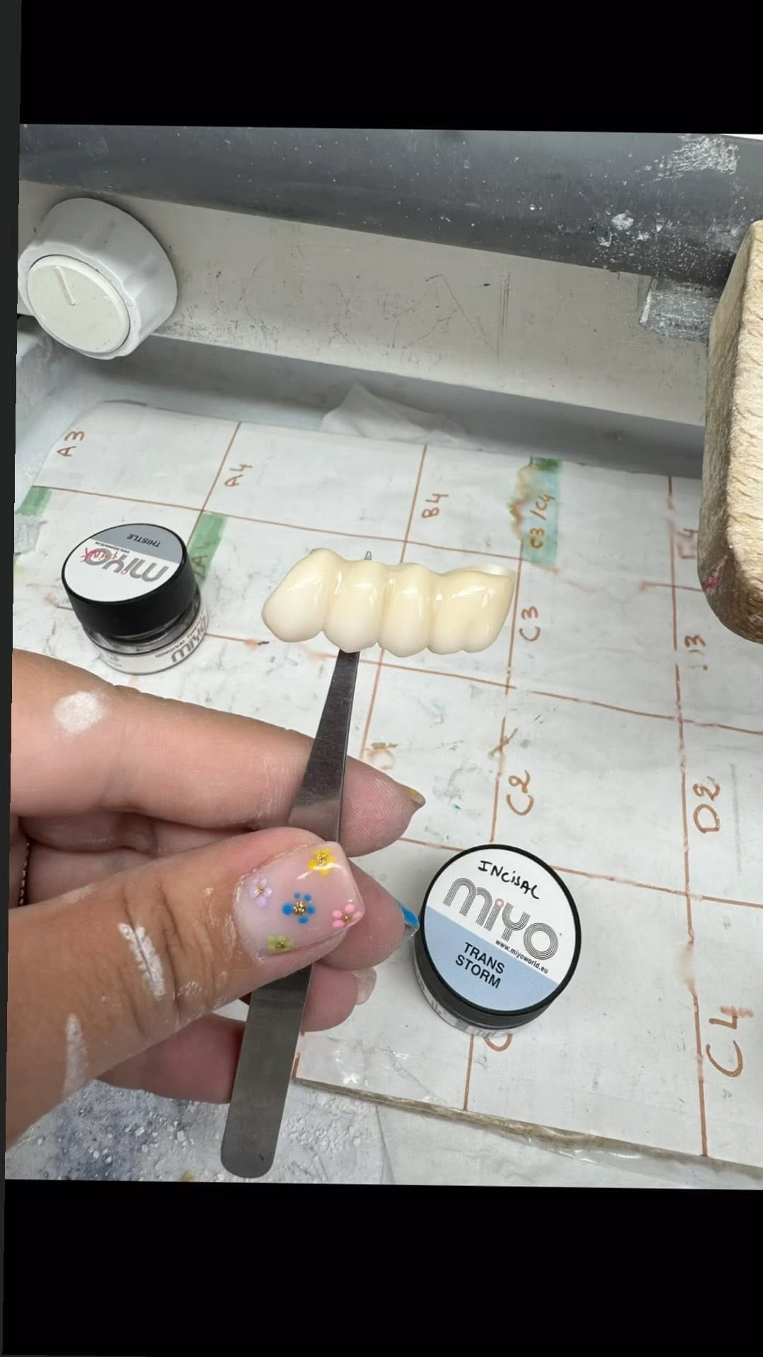 Post 10 by 🦷Séysha dental🦷 on Instagram (video)