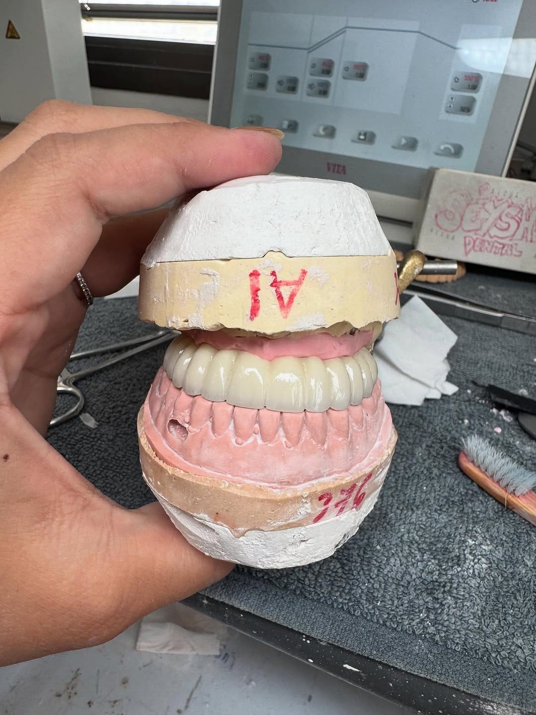 Post 7 by 🦷Séysha dental🦷 on Instagram (carousel)