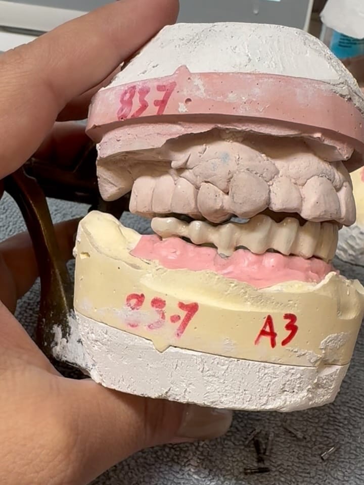 Post 5 by 🦷Séysha dental🦷 on Instagram (carousel)