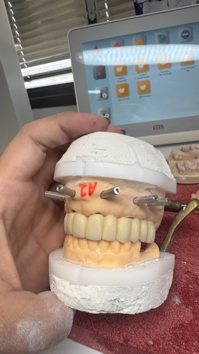Post 8 by 🦷Séysha dental🦷 on Instagram (video)