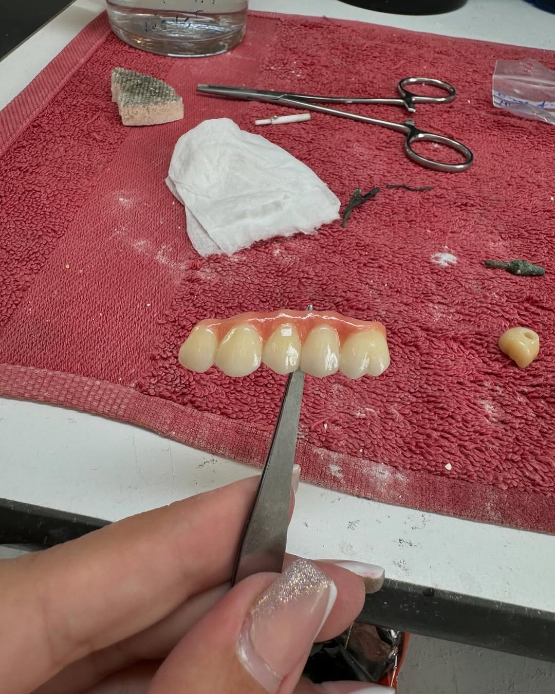 Post 9 by 🦷Séysha dental🦷 on Instagram (image)
