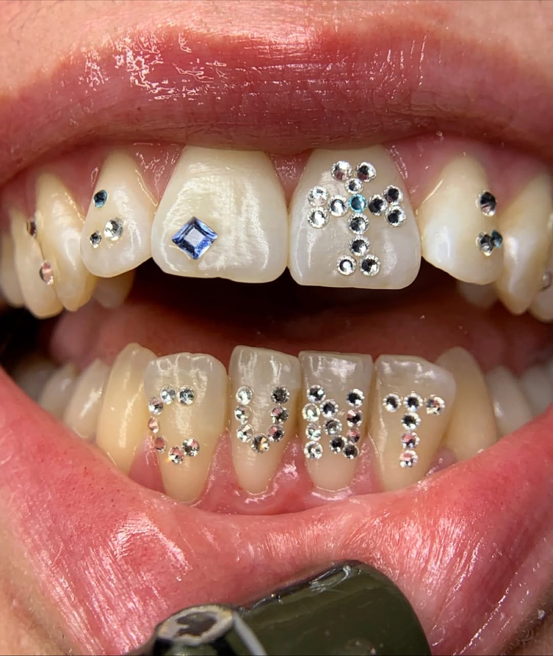 Post 6 by Toothgems Barcelona / Gemas Dentales on Instagram (image)