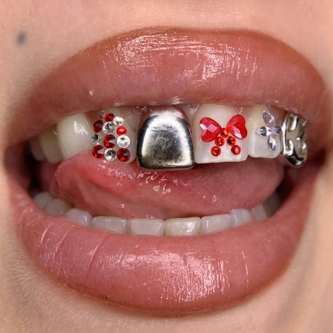 Post 4 by Toothgems Barcelona / Gemas Dentales on Instagram (image)