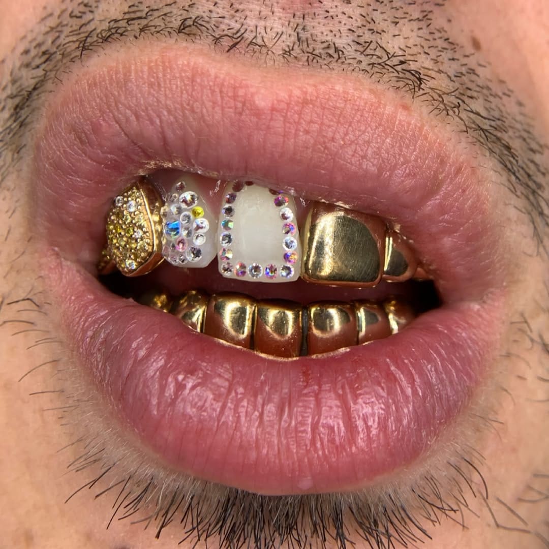 Post 2 by Toothgems Barcelona / Gemas Dentales on Instagram (image)
