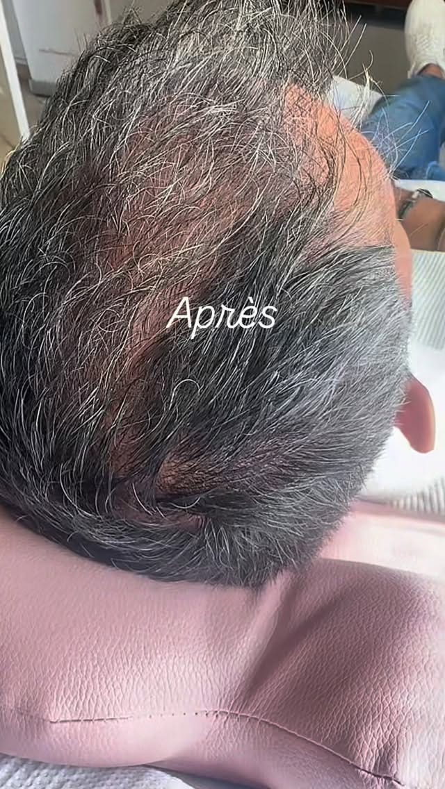 Post 7 by Dr Cyrine Daoud Ben Hmida on Instagram (video)