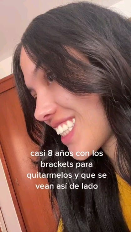 Post 10 by Ortodoncia Dra Airy Hernández on Instagram (video)