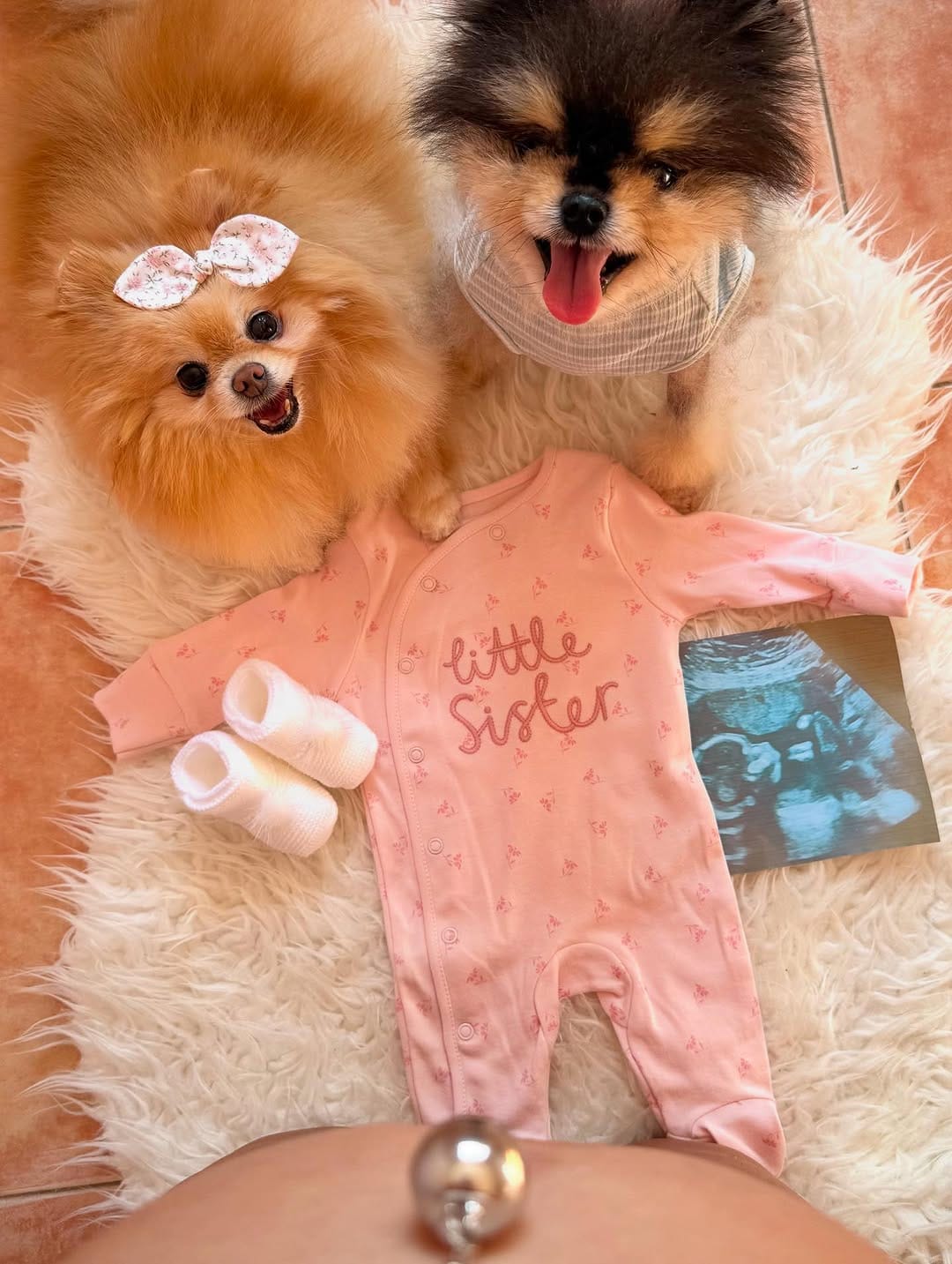 Post 5 by 🎀Valentina, BabyTous & Aixa🎀 on Instagram (image)