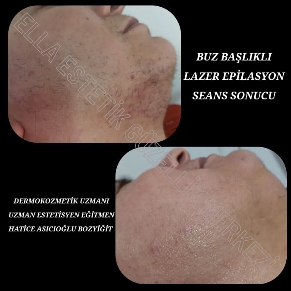 Post 7 by ELLA ESTETİK GÜZELLİK MERKEZİ on Instagram (image)