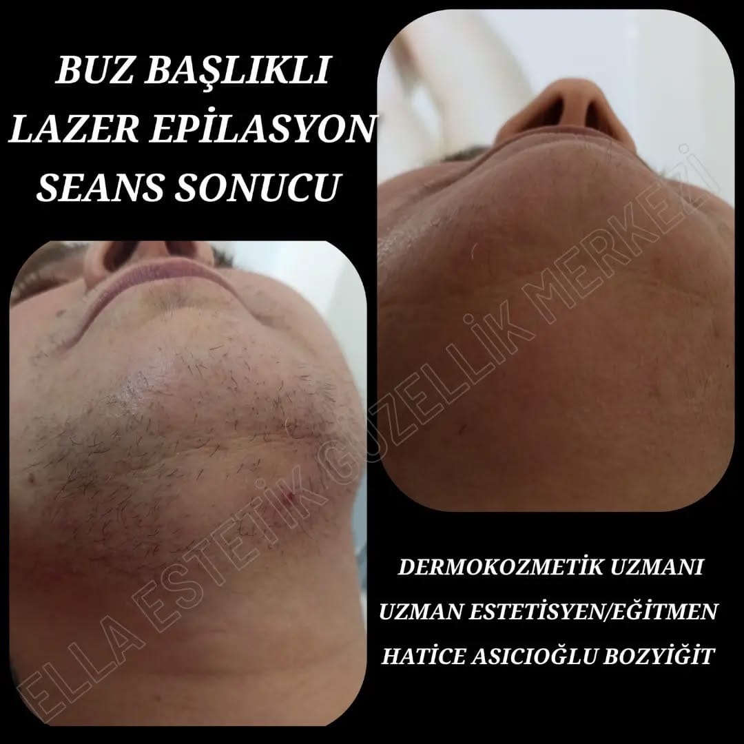 Post 10 by ELLA ESTETİK GÜZELLİK MERKEZİ on Instagram (image)