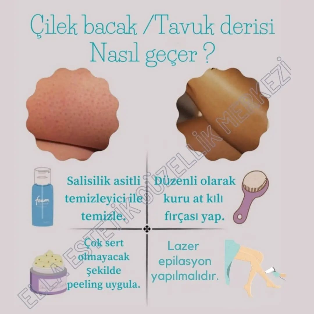 Post 6 by ELLA ESTETİK GÜZELLİK MERKEZİ on Instagram (image)