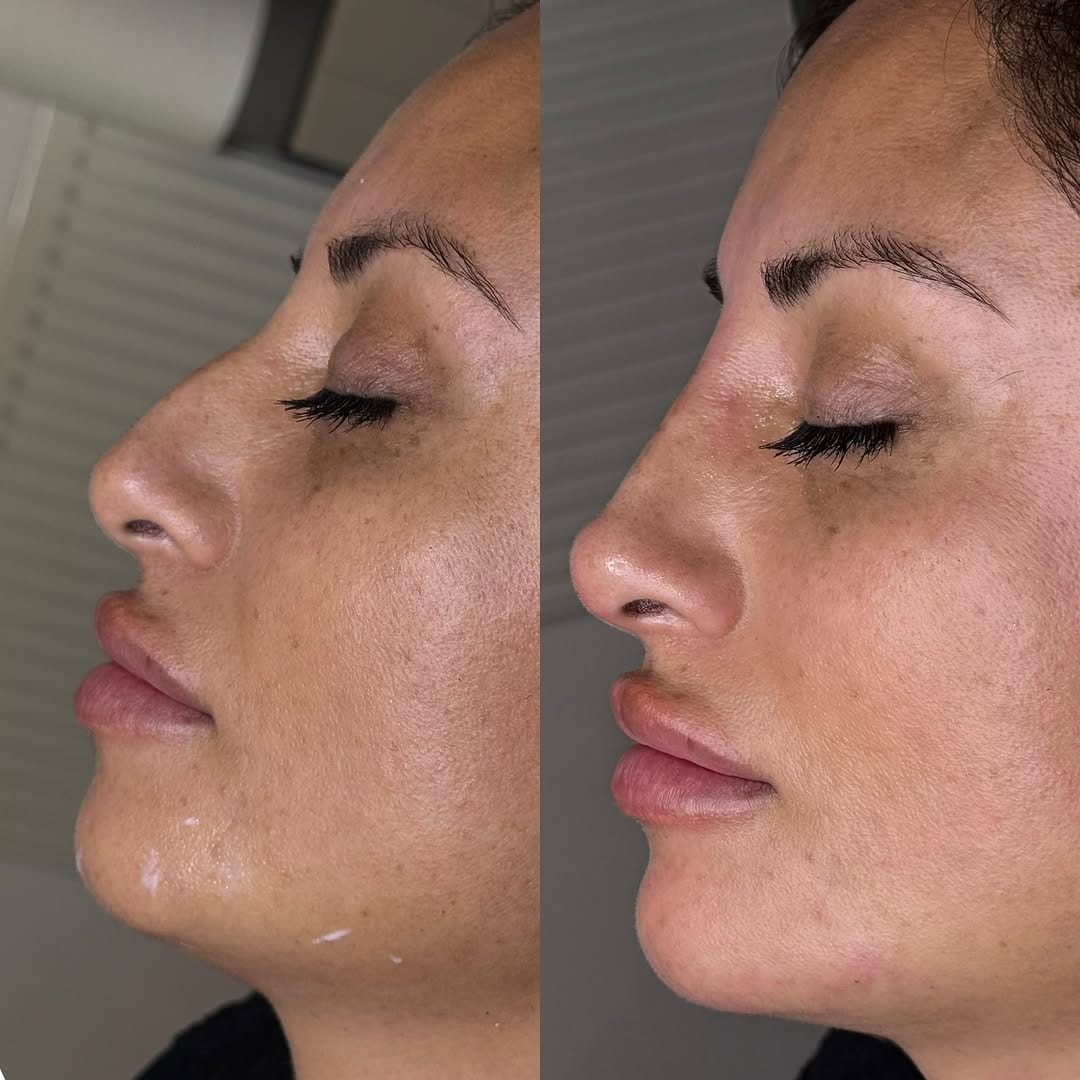 Post 1 by Aesthetics Parlour on Instagram (image)