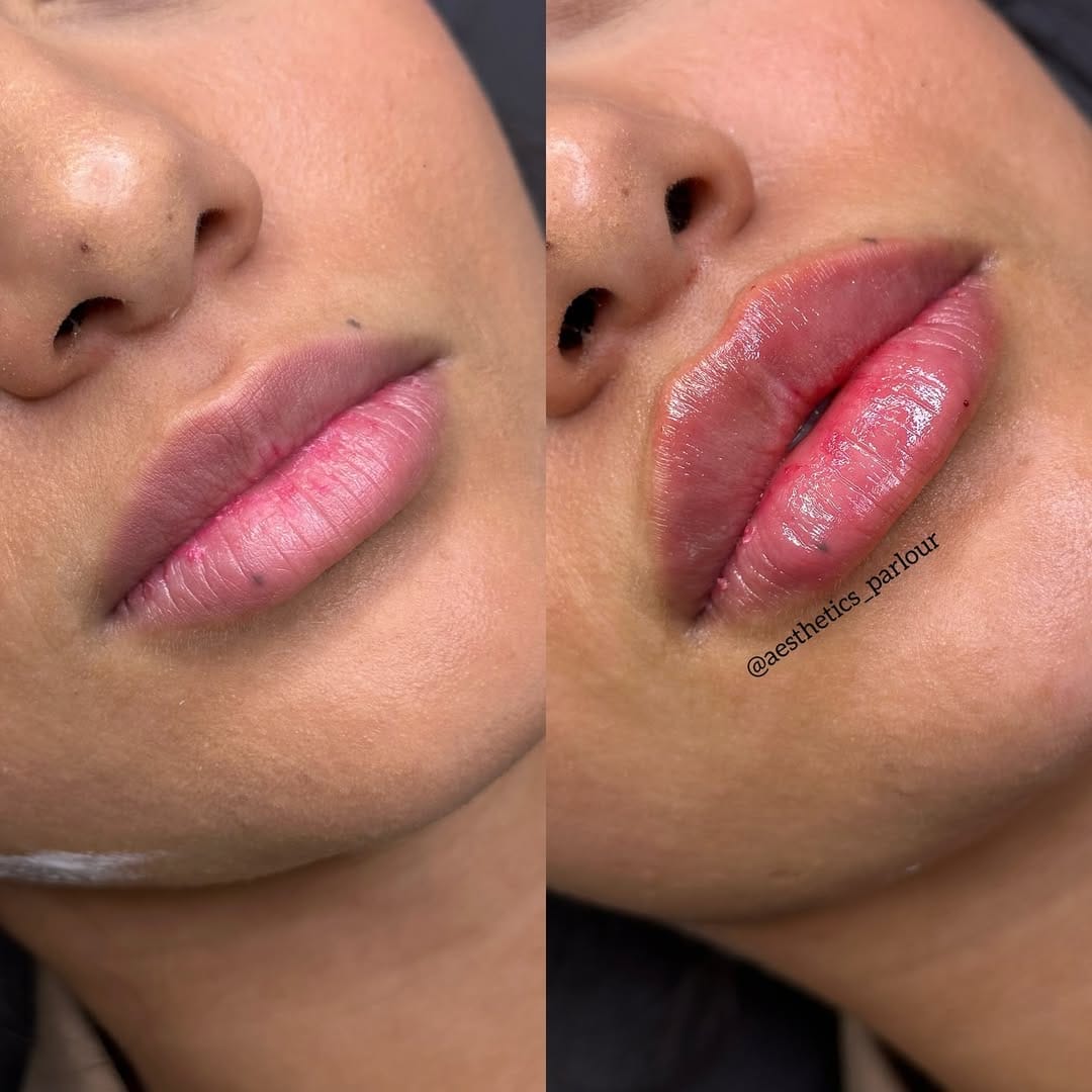 Post 8 by Aesthetics Parlour on Instagram (image)