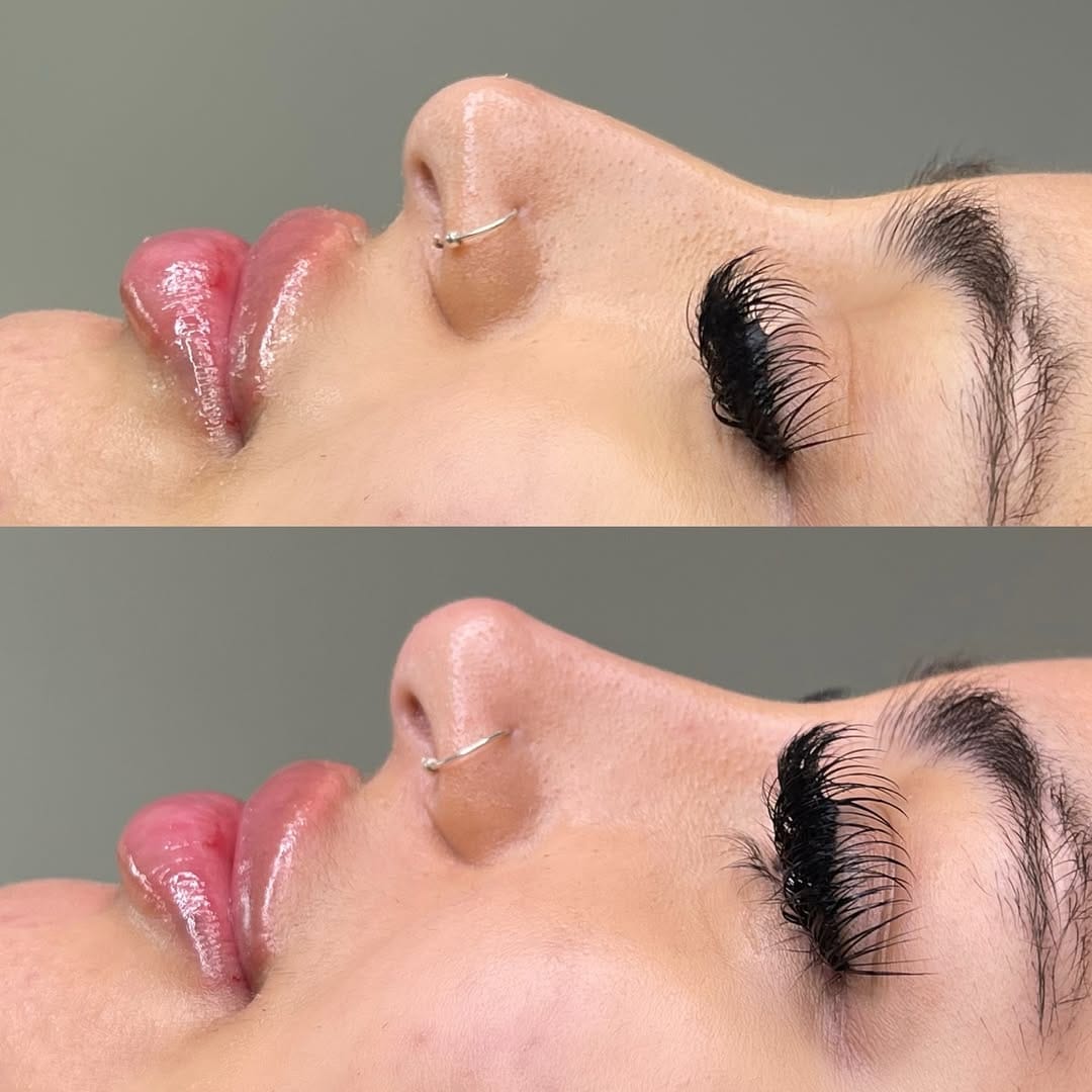 Post 6 by Aesthetics Parlour on Instagram (image)