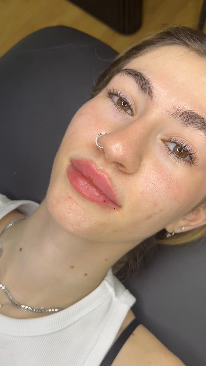 Post 5 by Aesthetics Parlour on Instagram (video)