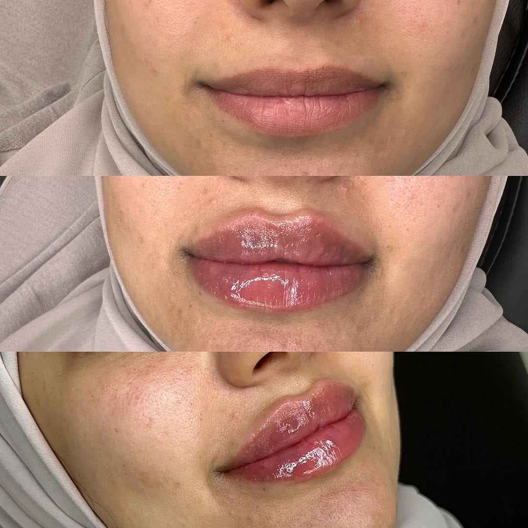 Post 4 by Aesthetics Parlour on Instagram (image)