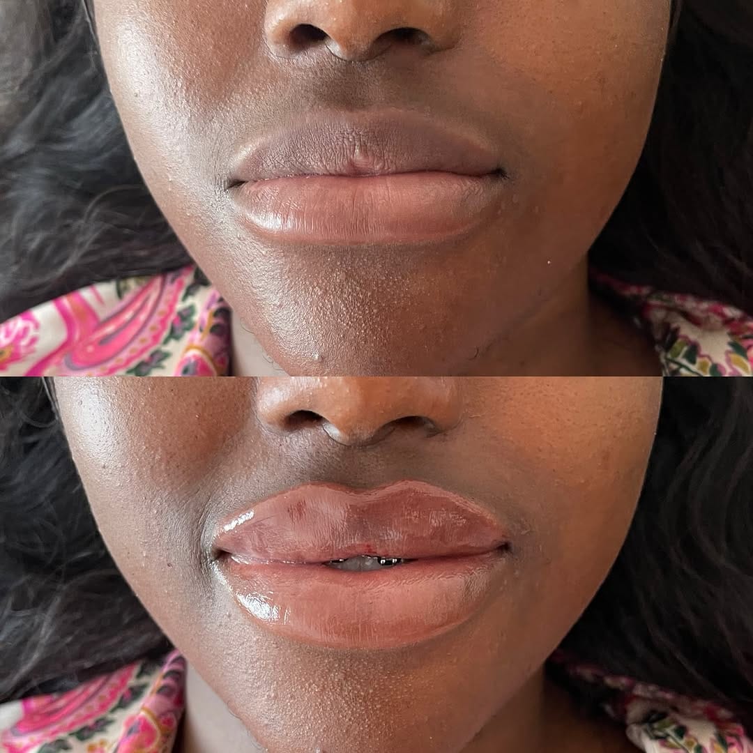 Post 3 by Aesthetics Parlour on Instagram (image)