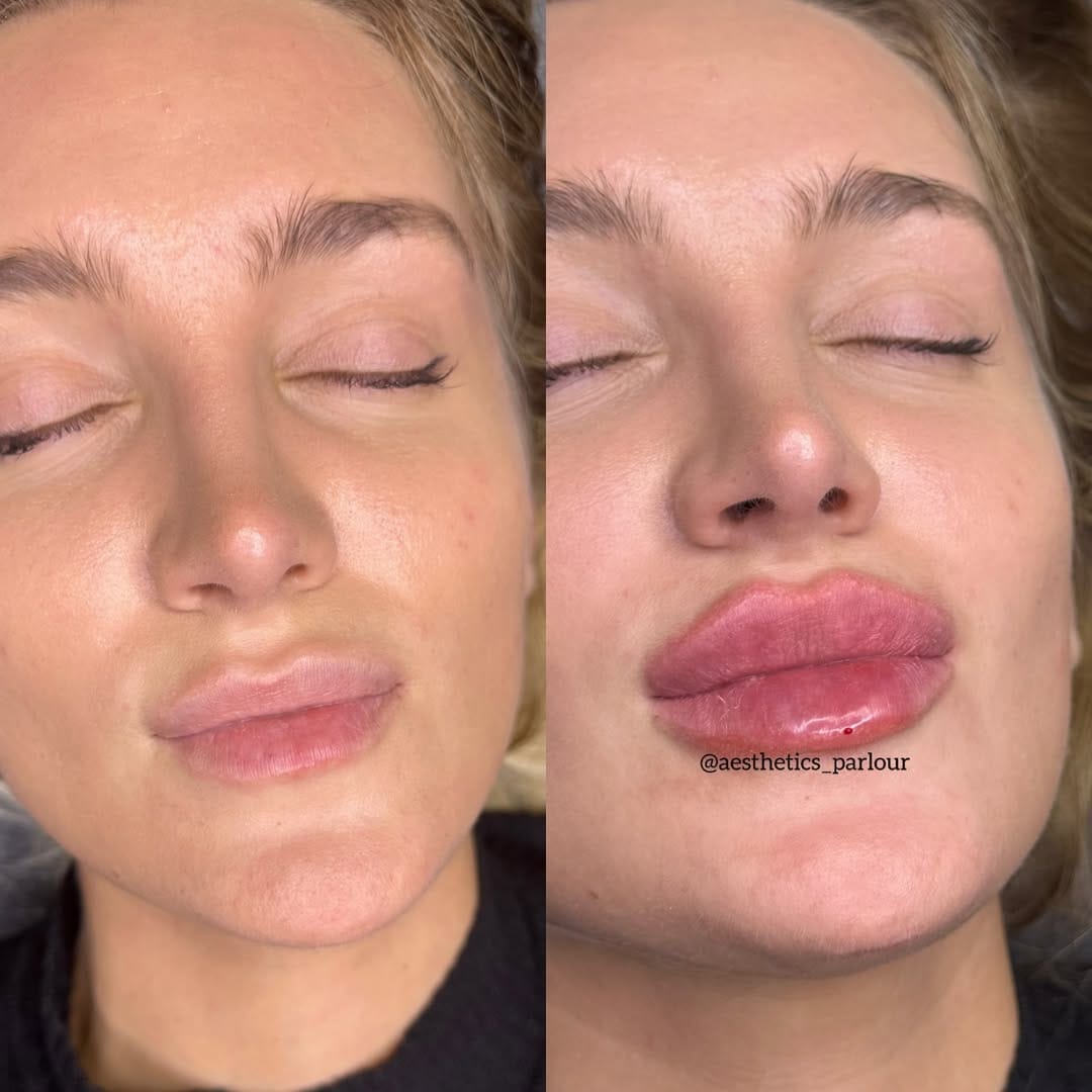 Post 10 by Aesthetics Parlour on Instagram (image)