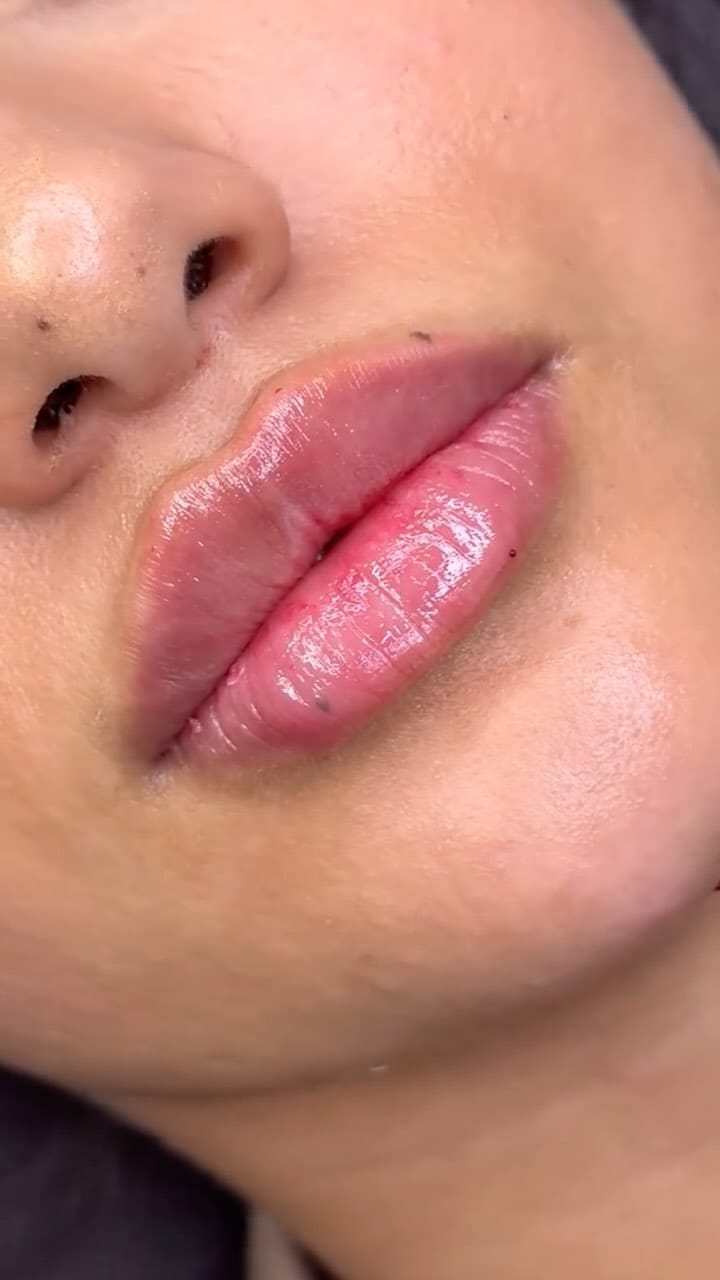 Post 9 by Aesthetics Parlour on Instagram (video)